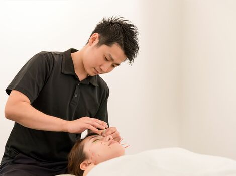 美容鍼を行う男性スタッフ