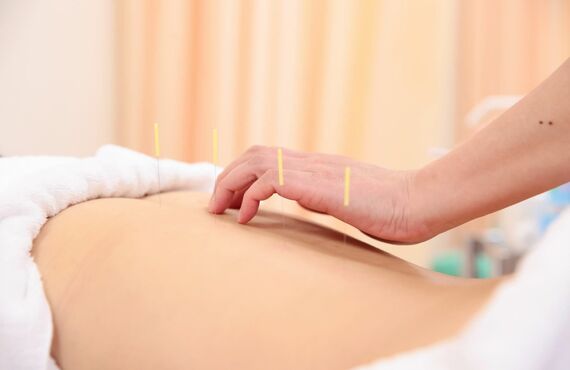 徳島で猫背を改善へと導く鍼灸の施術を行いお喜びいただいてまいりました